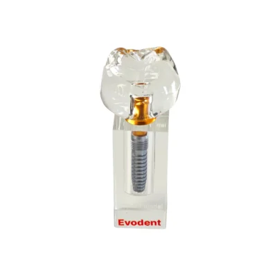 Evodent Implant Display Demonstration Model for Chairside Patient Education