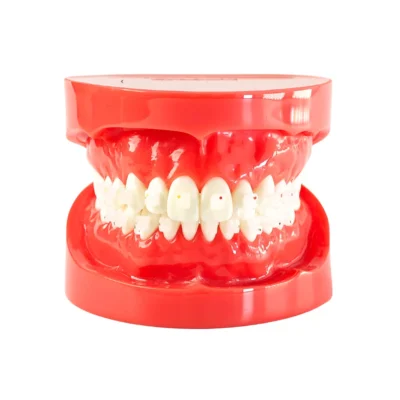 Evodent Orthodontic Model with ceramic brackets demonstrating aesthetic orthodontic appliance placement on natural-looking teeth. Ideal for patient education and orthodontic training to explain clear brace treatment options