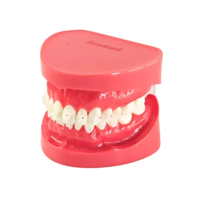 Evodent Orthodontic Model with Ceramic Bracket