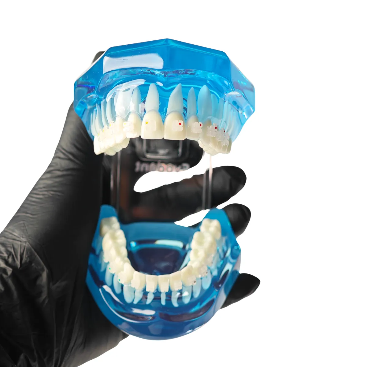 Evodent Orthodontic Model With Ceramic Brackets For Patient Education Model | Buy Now At Evodent Evodent orthodontic model with ceramic brackets for patient education model