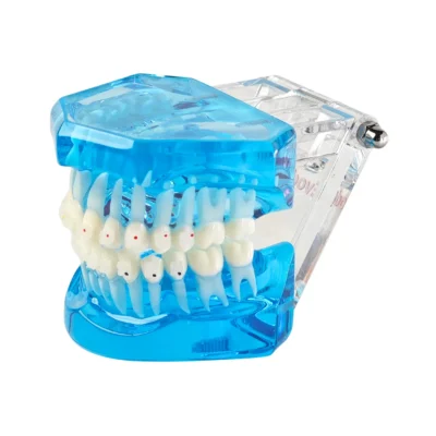 Evodent Orthodontic Model with Ceramic Brackets for Patient Education Model