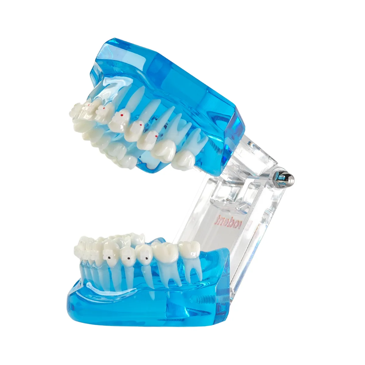Evodent Orthodontic Model With Ceramic Brackets For Patient Education Model | Buy Now At Evodent Evodent orthodontic model with ceramic brackets for patient education model