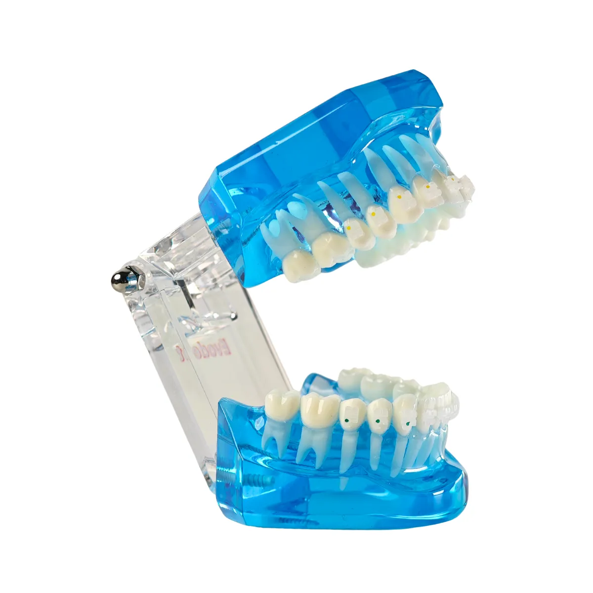 Evodent Orthodontic Model With Ceramic Brackets For Patient Education Model | Buy Now At Evodent Evodent orthodontic model with ceramic brackets for patient education model