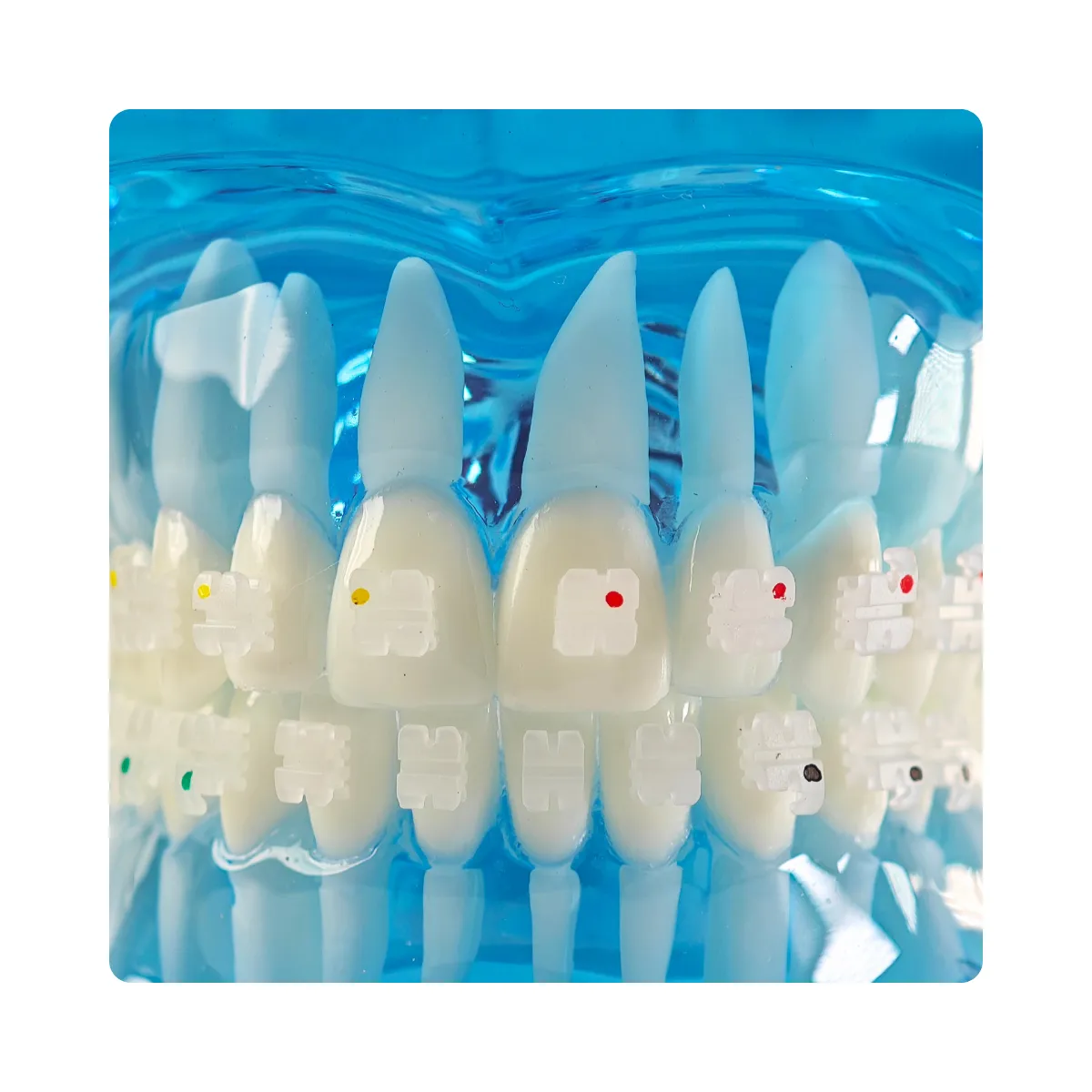 Evodent Orthodontic Model With Ceramic Brackets For Patient Education Model | Buy Now At Evodent Evodent orthodontic model with ceramic brackets for patient education model