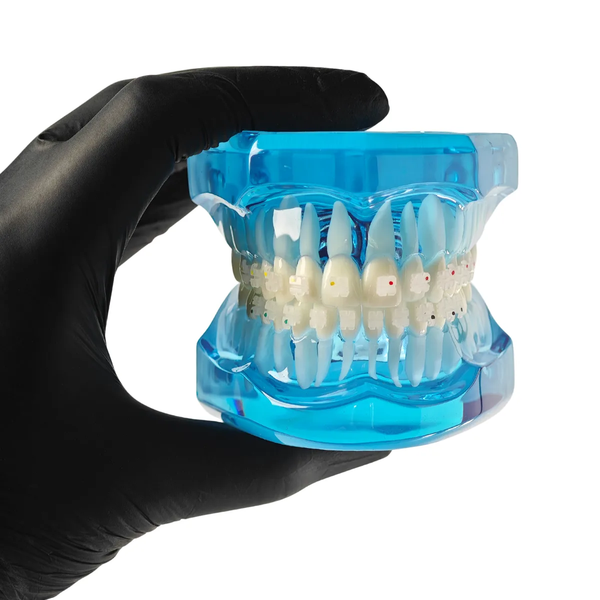 Evodent Orthodontic Model With Ceramic Brackets For Patient Education Model | Buy Now At Evodent Evodent orthodontic model with ceramic brackets for patient education model