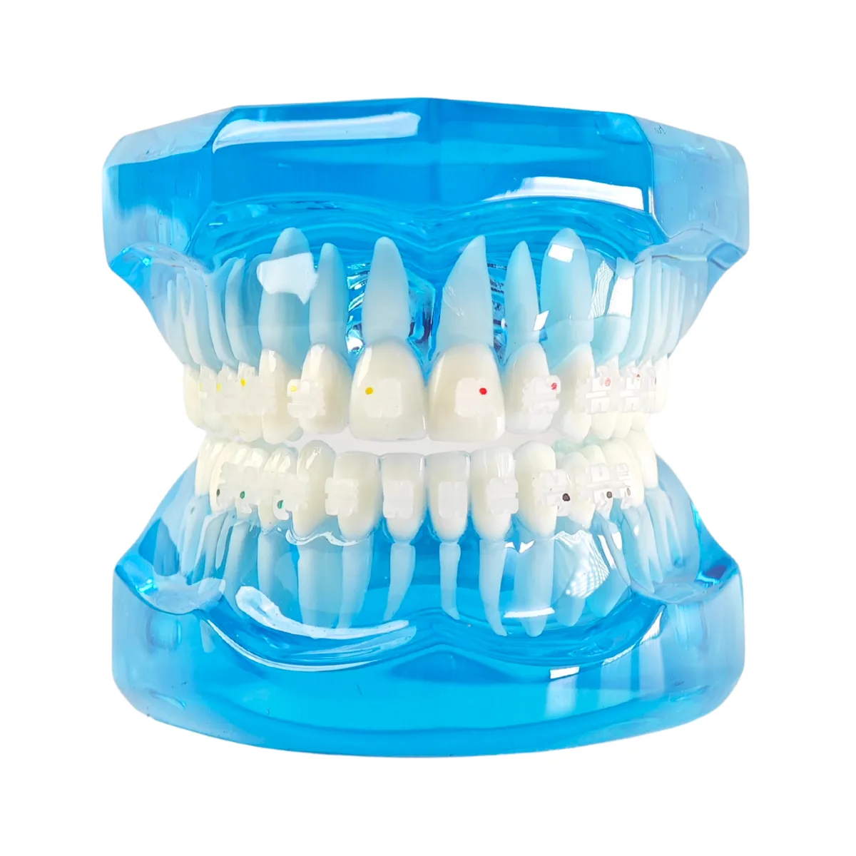 Evodent Orthodontic Model With Ceramic Brackets For Patient Education Model | Buy Now At Evodent Evodent orthodontic model with ceramic brackets for patient education model