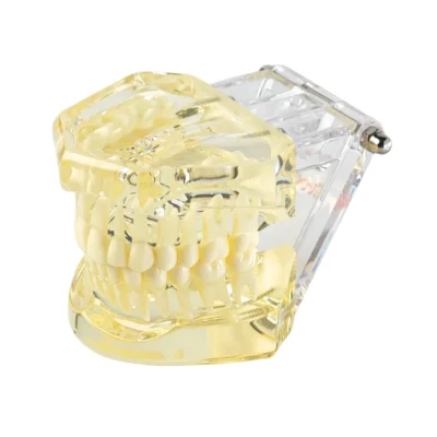 Evodent Orthodontic Model with Lingual Bracket