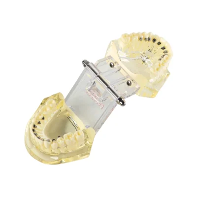 Evodent Orthodontic Model demonstrating lingual bracket placement on the inner tooth surface for discreet orthodontic treatment. Ideal for dental education, patient explanation, and orthodontic training