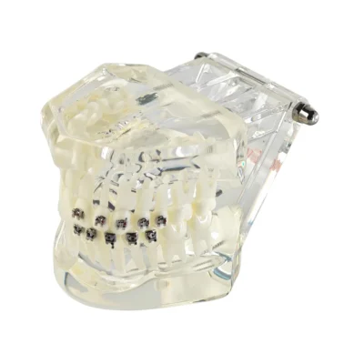 Evodent Four in One Orthodontic Bracket Types Demonstration Model - Metal, Ceramic, Self-Ligating & Lingual Braces