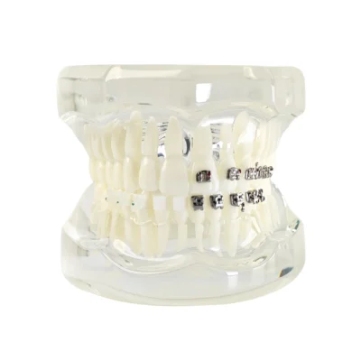 Evodent Four in One Orthodontic Bracket Types Demonstration Model - Metal, Ceramic, Self-Ligating & Lingual Braces