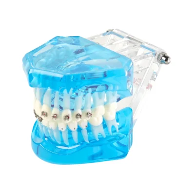 Evodent Orthodontic Model with Self Ligating Bracket