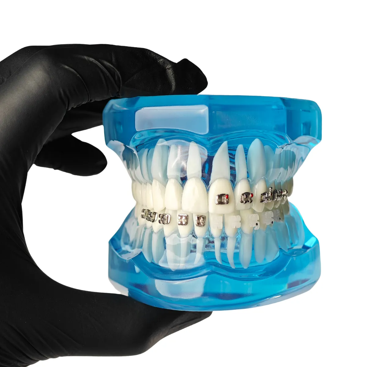 Evodent Three In One Orthodontic Model With Self Ligating Bracket | Buy Now At Evodent Evodent orthodontic model with self ligating bracket