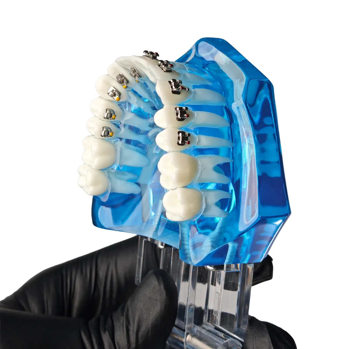 Evodent Three In One Orthodontic Model With Self Ligating Bracket | Buy Now At Evodent Evodent orthodontic model with self ligating bracket