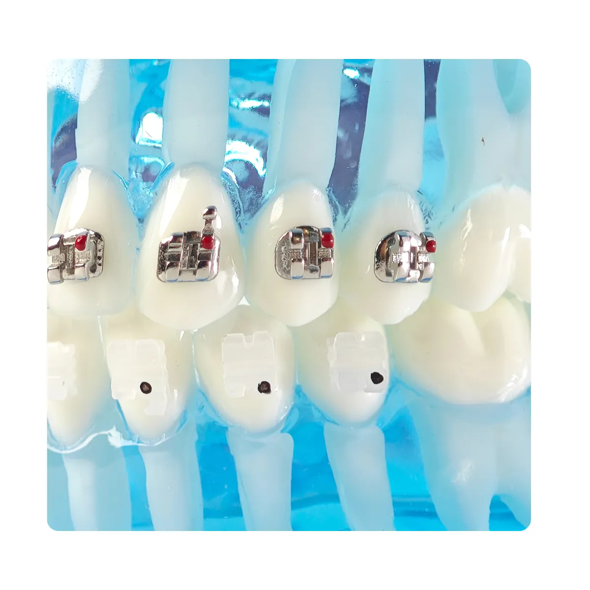 Evodent Three In One Orthodontic Model With Self Ligating Bracket | Buy Now At Evodent Evodent orthodontic model with self ligating bracket