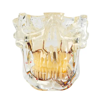 Evodent Signature Orthognathic and Osteology Model for TMJ Anatomy, Jaw Movement and Maxillofacial Relationship Demonstration
