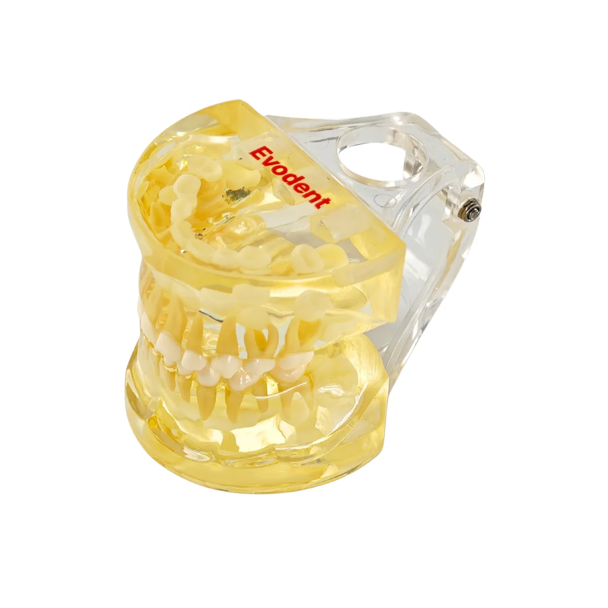 Evodent Pediatric Patient Education Dental Model For 3 Year Child Showing Primary Dentition (Milk Teeth) | Buy Now At Evodent Evodent pediatric patient education dental model for 3 year child showing primary dentition (milk teeth)