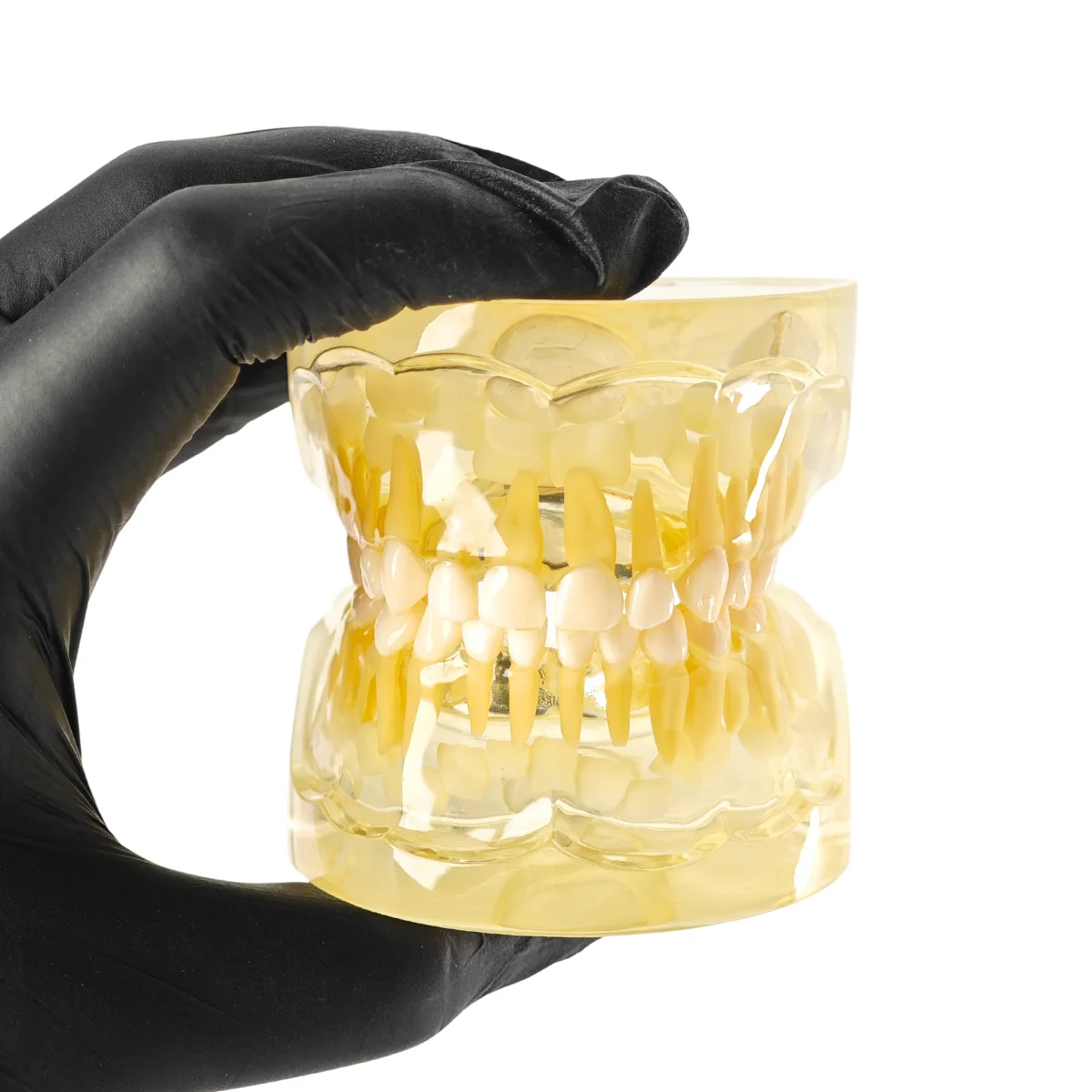 Evodent Pediatric Patient Education Dental Model For 3 Year Child Showing Primary Dentition (Milk Teeth) | Buy Now At Evodent Evodent pediatric patient education dental model for 3 year child showing primary dentition (milk teeth)