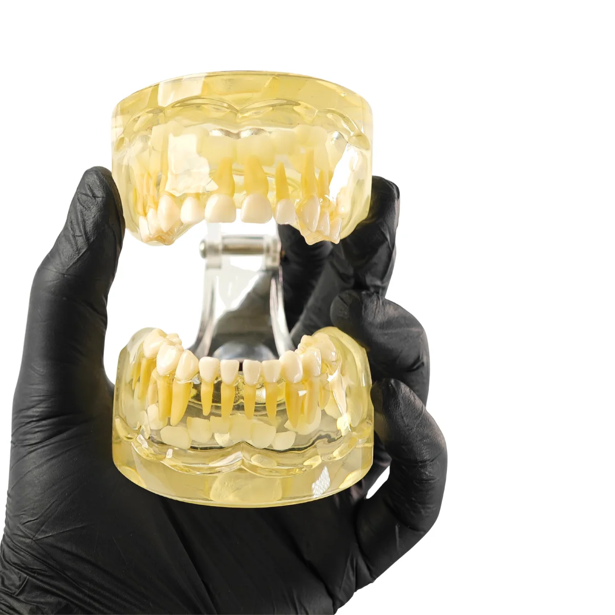 Evodent Pediatric Patient Education Dental Model For 3 Year Child Showing Primary Dentition (Milk Teeth) | Buy Now At Evodent Evodent pediatric patient education dental model for 3 year child showing primary dentition (milk teeth)