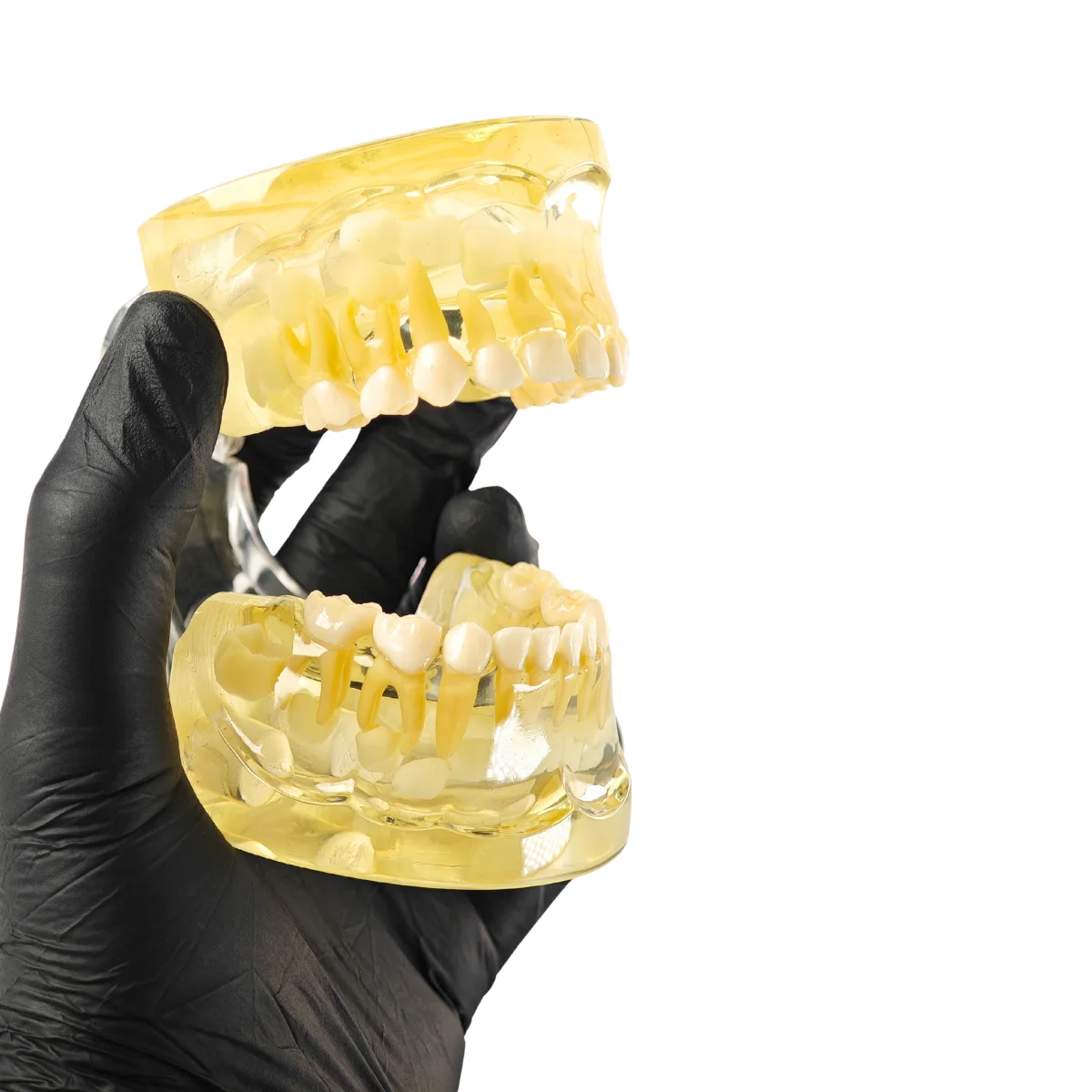 Evodent Pediatric Patient Education Dental Model For 3 Year Child Showing Primary Dentition (Milk Teeth) | Buy Now At Evodent Evodent pediatric patient education dental model for 3 year child showing primary dentition (milk teeth)