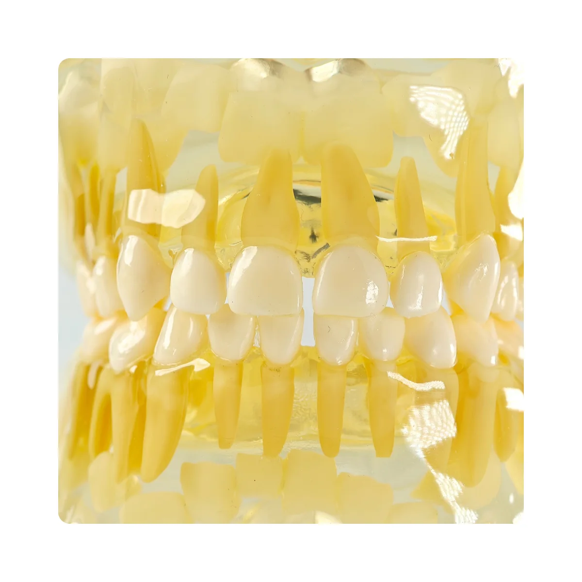 Evodent Pediatric Patient Education Dental Model For 3 Year Child Showing Primary Dentition (Milk Teeth) | Buy Now At Evodent Evodent pediatric patient education dental model for 3 year child showing primary dentition (milk teeth)