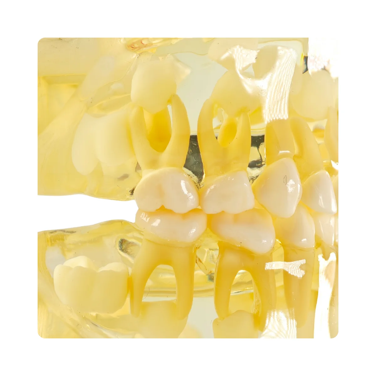 Evodent Pediatric Patient Education Dental Model For 3 Year Child Showing Primary Dentition (Milk Teeth) | Buy Now At Evodent Evodent pediatric patient education dental model for 3 year child showing primary dentition (milk teeth)