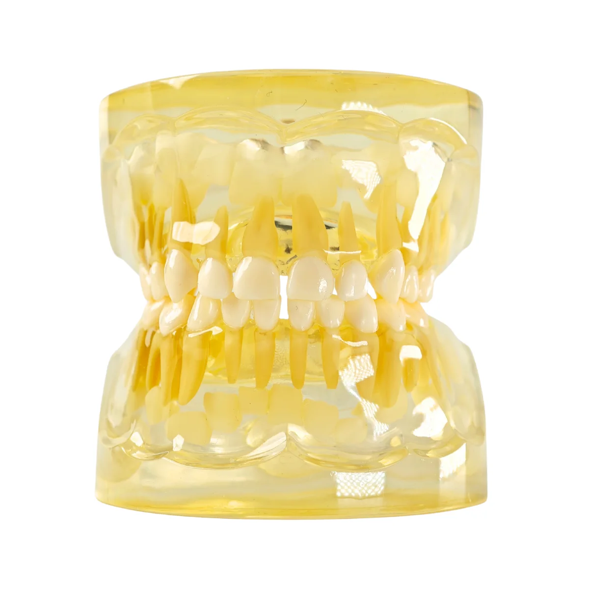 Evodent Pediatric Patient Education Dental Model For 3 Year Child Showing Primary Dentition (Milk Teeth) | Buy Now At Evodent Evodent pediatric patient education dental model for 3 year child showing primary dentition (milk teeth)