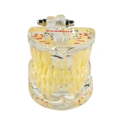 Evodent Pediatric Patient Education Dental Model for 7 Year Child, Mixed Dentition and Erupting Permanent Teeth Evodent Pediatric Patient Education Dental Model for 7 Year Child, Mixed Dentition and Erupting Permanent Teeth