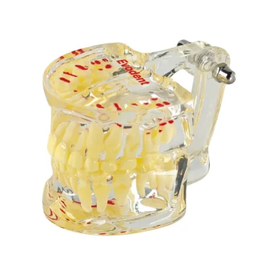 Evodent Pediatric Patient Education Dental Model for 7 Year Child, Mixed Dentition and Erupting Permanent Teeth