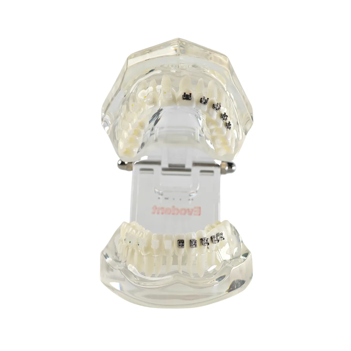 Evodent Orthodontic Model With Metal And Ceramic Brackets For Patient Education, Metal Vs Ceramic Brackets Comparison Model | Buy Now At Evodent Evodent orthodontic model with metal and ceramic brackets for patient education, metal vs ceramic brackets comparison model