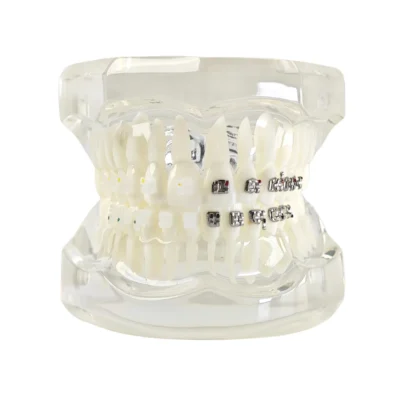 Home | Buy Now At Evodent Evodent orthodontic model with metal and ceramic brackets for patient education, metal vs ceramic brackets comparison model
