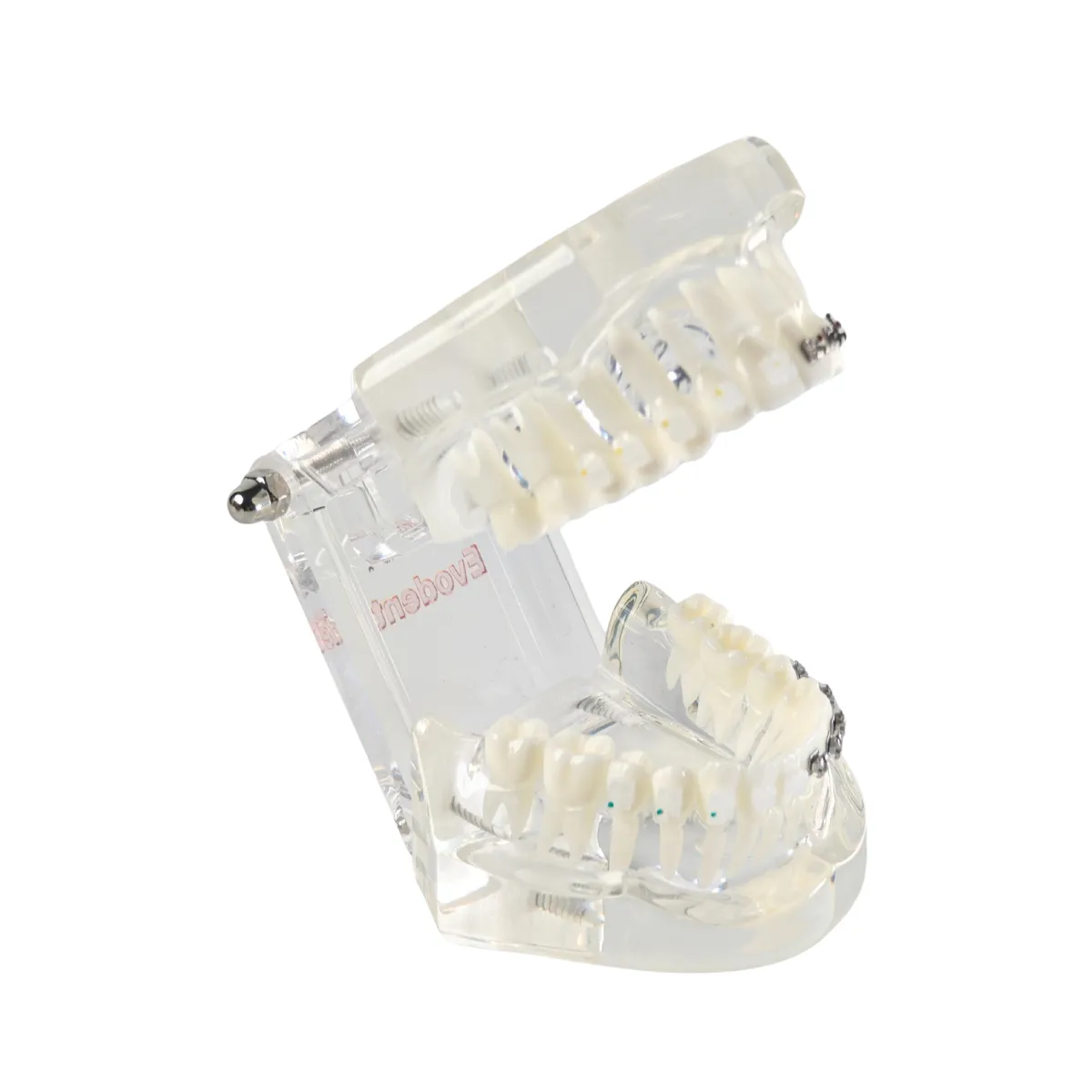 Evodent Orthodontic Model With Metal And Ceramic Brackets For Patient Education, Metal Vs Ceramic Brackets Comparison Model | Buy Now At Evodent Evodent orthodontic model with metal and ceramic brackets for patient education, metal vs ceramic brackets comparison model