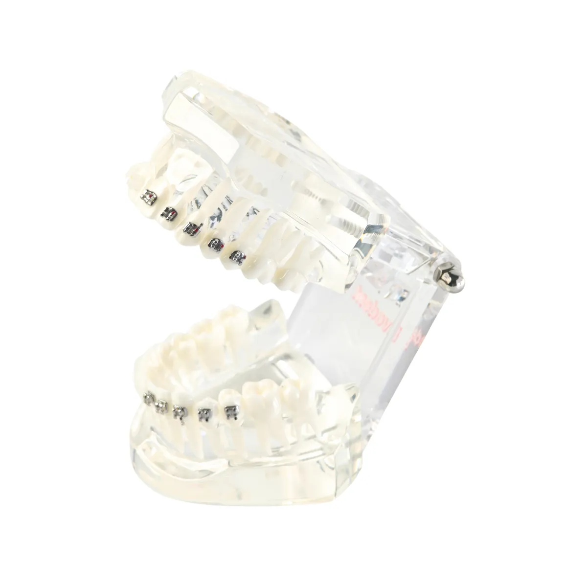 Evodent Orthodontic Model With Metal And Ceramic Brackets For Patient Education, Metal Vs Ceramic Brackets Comparison Model | Buy Now At Evodent Evodent orthodontic model with metal and ceramic brackets for patient education, metal vs ceramic brackets comparison model