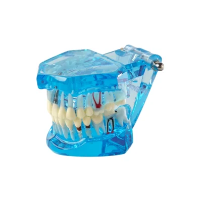 Home | Buy Now At Evodent Evodent all in one blue dental model designed to demonstrate teeth, roots, nerves, and jaw anatomy