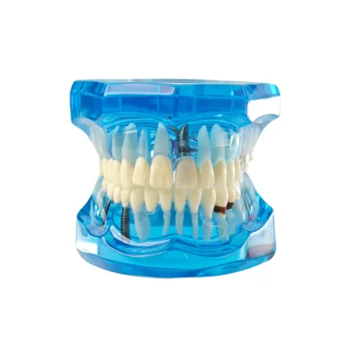 Evodent All In One Dental Model, Blue Evodent all in one dental model, blue