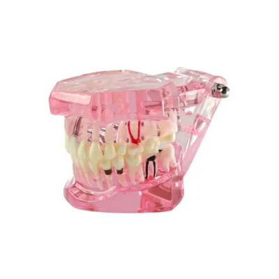 Home | Buy Now At Evodent Evodent all in one pink dental model designed to demonstrate teeth, roots, nerves, and complete jaw anatomy