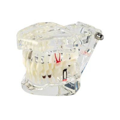 All In One Dental Models | Buy Now At Evodent Evodent all in one model, transparent