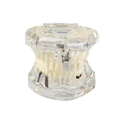 Evodent All In One Model,Transparent Evodent all in one model,transparent