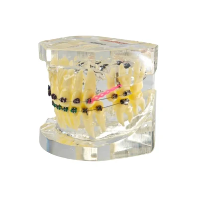 Evodent Orthodontic Demonstration Model With Metal Braces, Archwire And Power Chain Evodent orthodontic demonstration model with metal braces, archwire and power chain