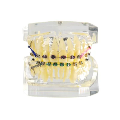 Home | Buy Now At Evodent Evodent orthodontic demonstration model with metal braces, archwire and power chain