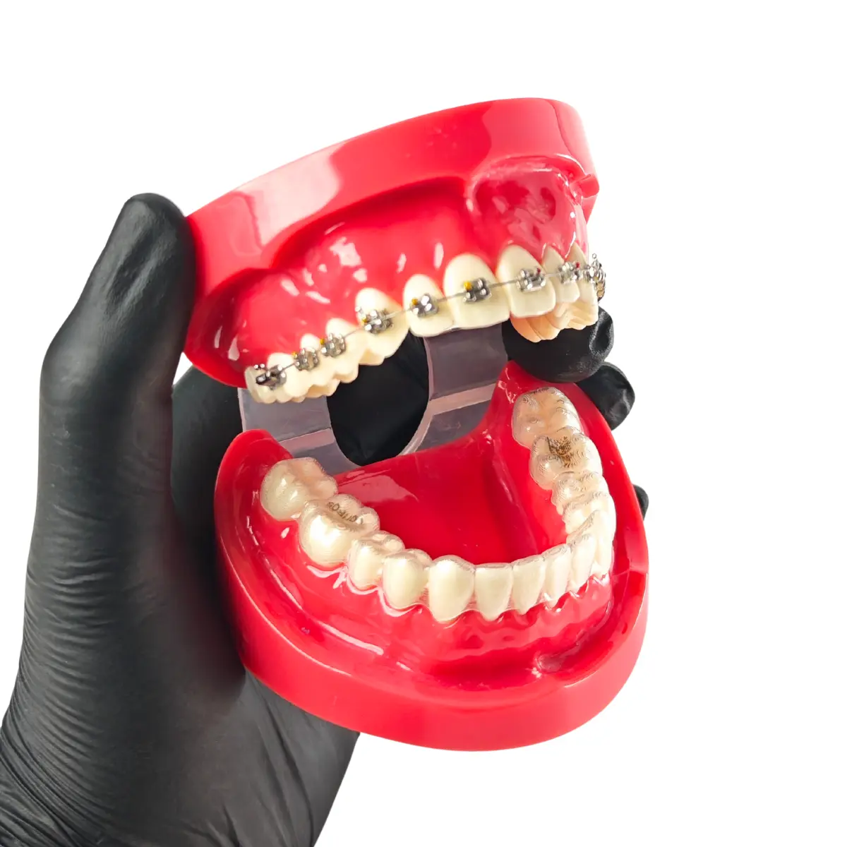 Evodent Orthodontic Braces Vs Aligners Comparison Model For Patient Education (Fixed Appliances Vs Clear Aligners) | Buy Now At Evodent Evodent orthodontic braces vs aligners comparison model for patient education (fixed appliances vs clear aligners)