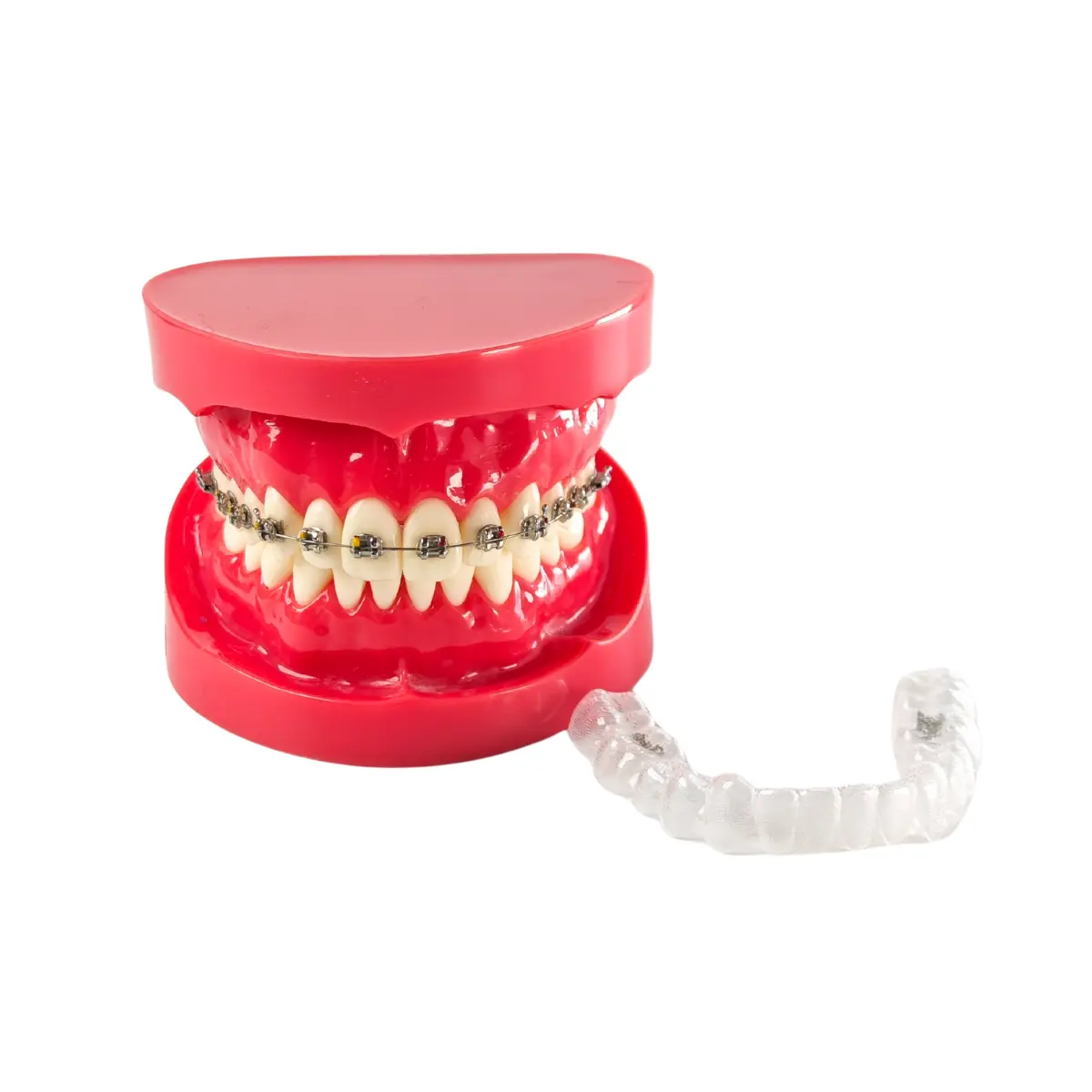 Evodent Orthodontic Braces Vs Aligners Comparison Model For Patient Education (Fixed Appliances Vs Clear Aligners) | Buy Now At Evodent Evodent orthodontic braces vs aligners comparison model for patient education (fixed appliances vs clear aligners)
