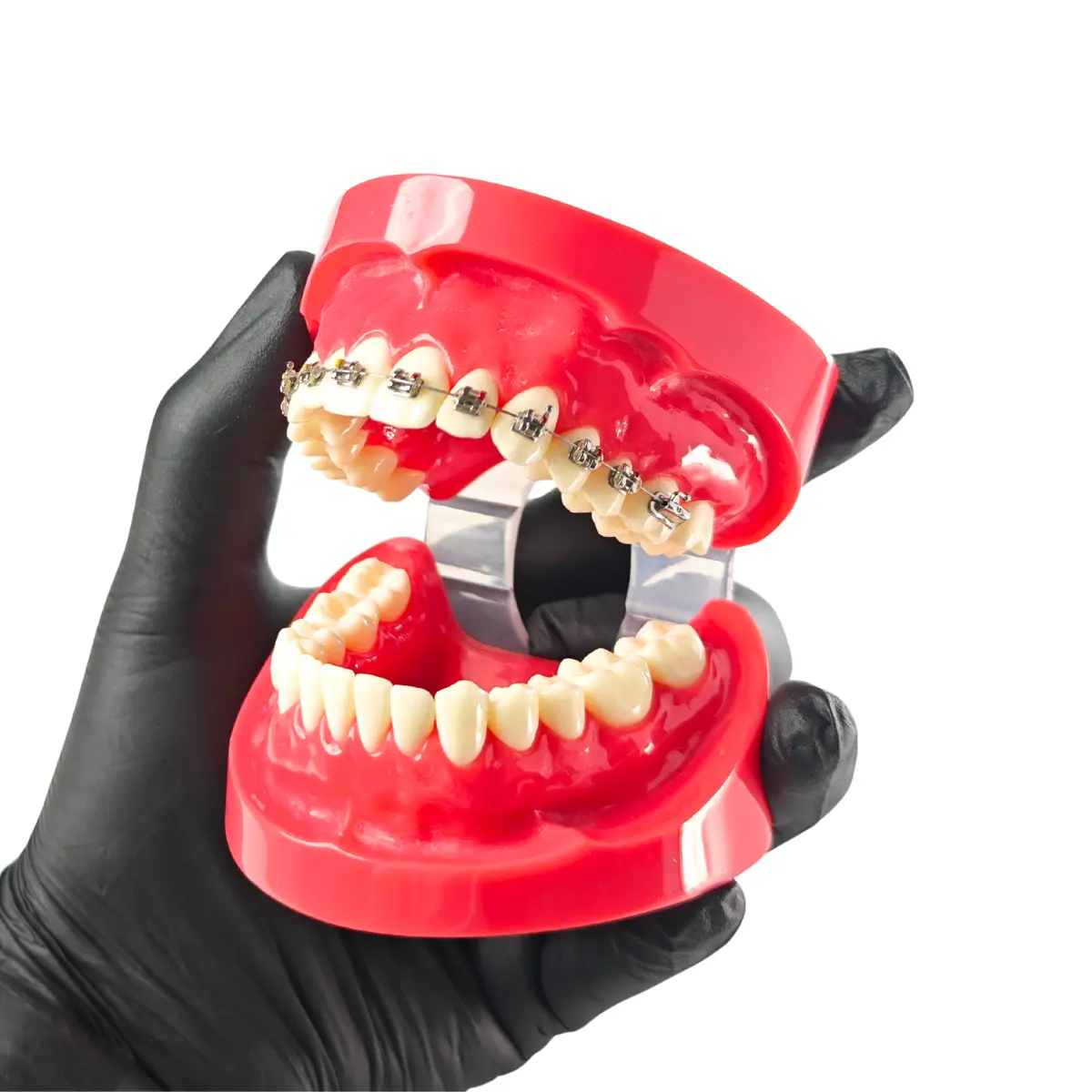 Evodent Orthodontic Braces Vs Aligners Comparison Model For Patient Education (Fixed Appliances Vs Clear Aligners) | Buy Now At Evodent Evodent orthodontic braces vs aligners comparison model for patient education (fixed appliances vs clear aligners)