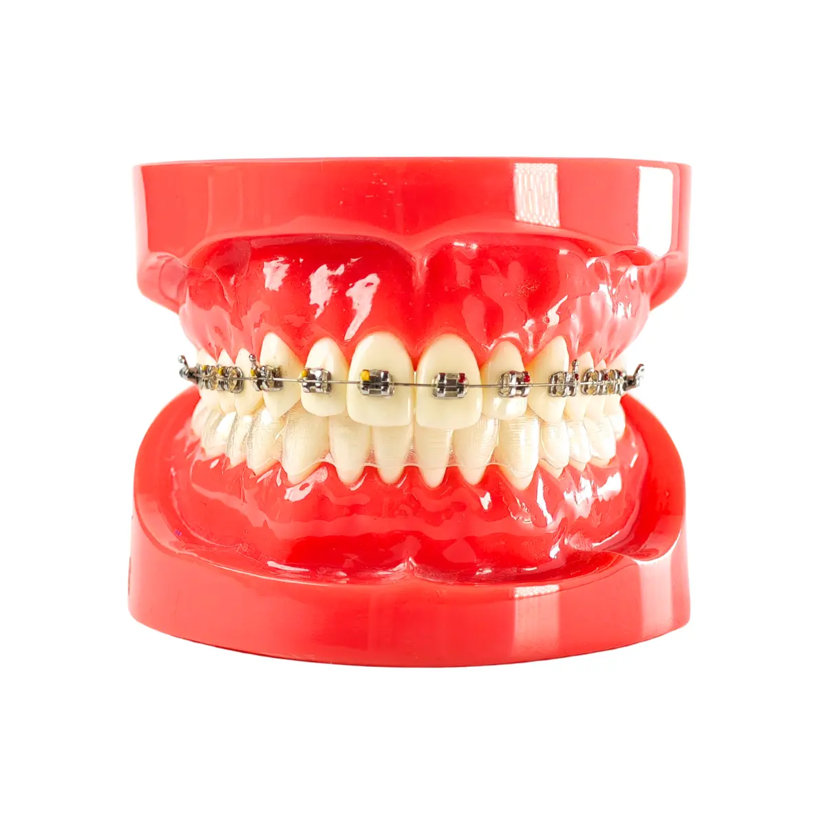Evodent Orthodontic Braces Vs Aligners Comparison Model For Patient Education (Fixed Appliances Vs Clear Aligners) | Buy Now At Evodent Evodent orthodontic braces vs aligners comparison model for patient education (fixed appliances vs clear aligners)