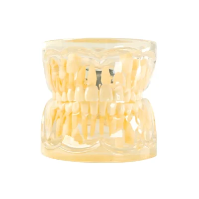 Evodent Pediatric Dental Patient Education Model for 9 Year Child - Mixed Dentition - Advanced Eruption Stage Dental Model