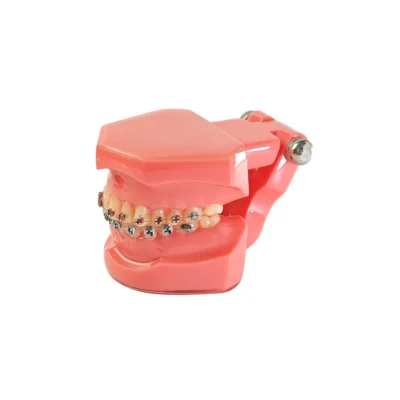 Evodent Orthodontic Model with Metal Bracket