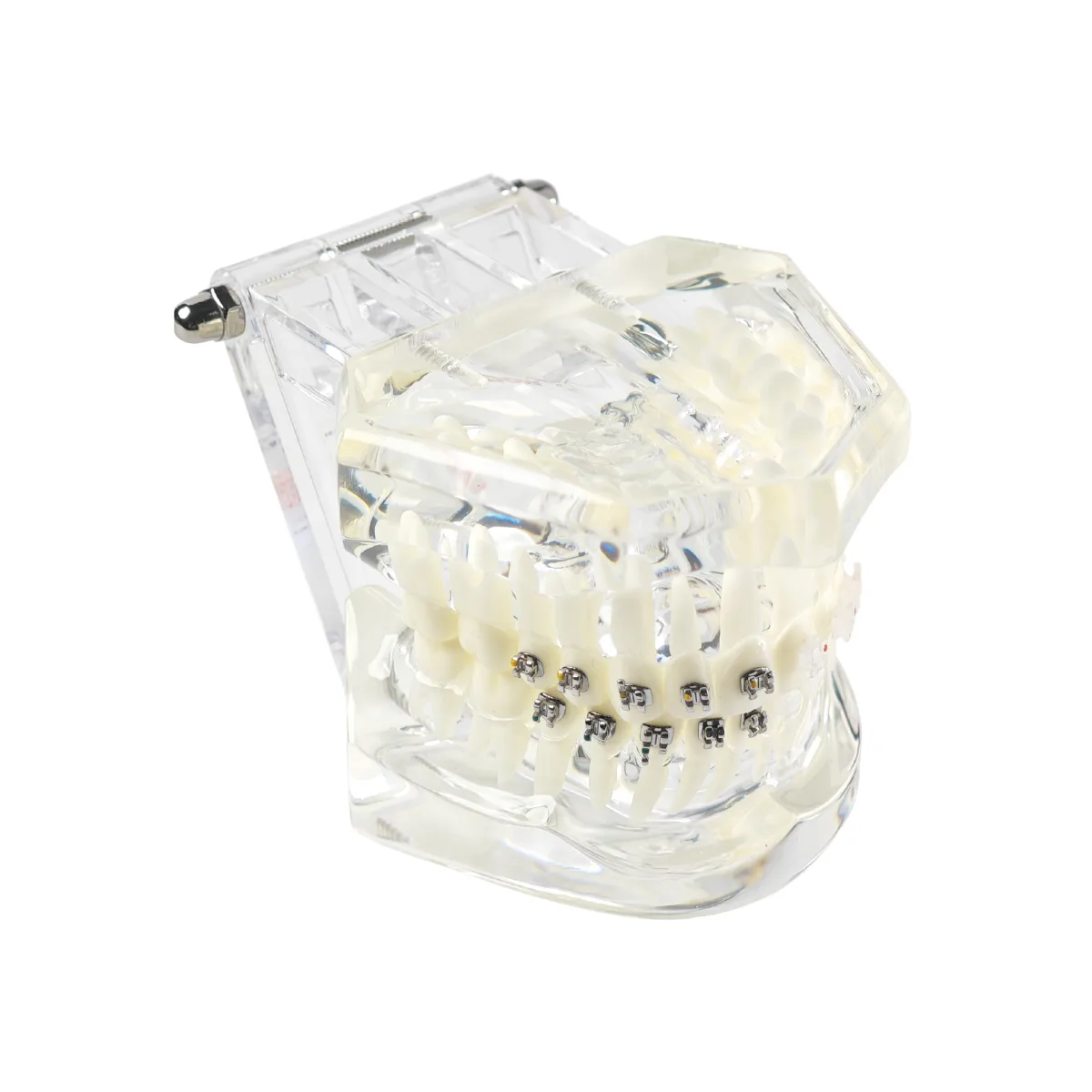 Evodent Orthodontic Model With Metal And Ceramic Brackets For Patient Education, Metal Vs Ceramic Brackets Comparison Model | Buy Now At Evodent Evodent orthodontic model with metal and ceramic brackets for patient education, metal vs ceramic brackets comparison model