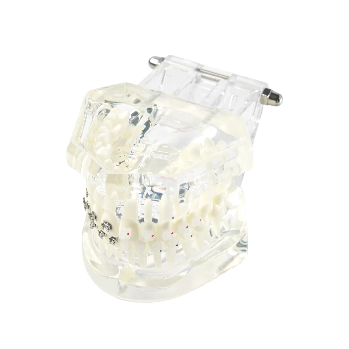 Evodent Orthodontic Model With Metal And Ceramic Brackets For Patient Education, Metal Vs Ceramic Brackets Comparison Model | Buy Now At Evodent Evodent orthodontic model with metal and ceramic brackets for patient education, metal vs ceramic brackets comparison model