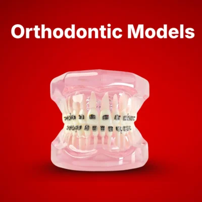 Orthodontic Models