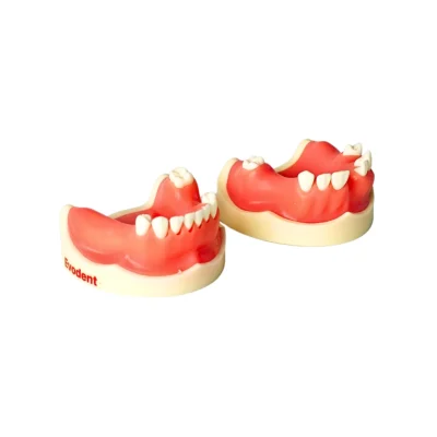 Evodent Partially Edentulous Implant Practice Model