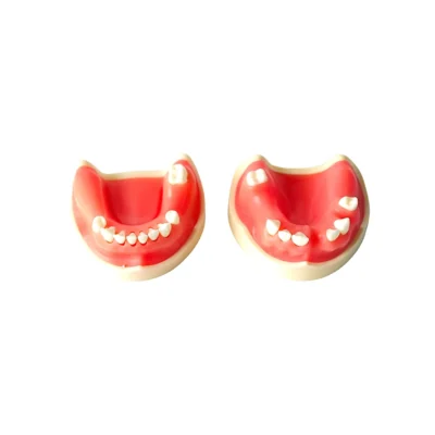 Evodent Partially Edentulous Implant Practice Model
